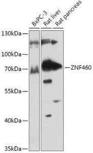 Anti-ZNF460 Rabbit Polyclonal Antibody