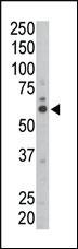 Anti-FYN Rabbit Polyclonal Antibody