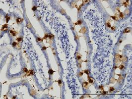 Anti-TFF3 Mouse Monoclonal Antibody [clone: 3D9]