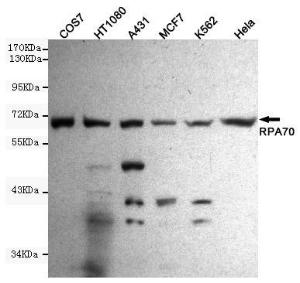 Anti-RPA1 Mouse Monoclonal Antibody [clone: 13k116]