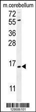 Anti-ANKRD39 Rabbit Polyclonal Antibody