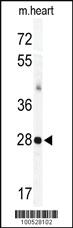 Anti-KCNIP3 Rabbit Polyclonal Antibody