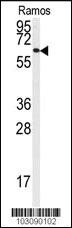 Anti-FYN Rabbit Polyclonal Antibody