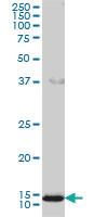 Anti-GOLGA7 Mouse Monoclonal Antibody [clone: 2H8]