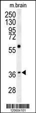 Anti-MAPRE1 Rabbit Polyclonal Antibody (Biotin)