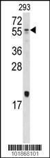 Anti-BMP10 Rabbit Polyclonal Antibody (AP (Alkaline Phosphatase))