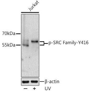 ANTI-LCK phospho Y416 FYN phospho 100 µl