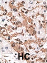 Anti-KCNIP3 Rabbit Polyclonal Antibody