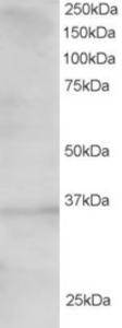 EB06068 staining (1.5µg/ml) of 293 lysate (RIPA buffer, 30µg total protein per lane).  Primary incubated for 1 hour.  Detected by western blot using chemiluminescence.