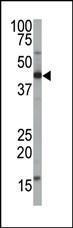 Anti-FNTA Rabbit Polyclonal Antibody (HRP (Horseradish Peroxidase))