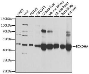 Western blot analysis of extracts of various cell lines, using Anti-BCKDHA Antibody (A308637) at 1:1,000 dilution The secondary antibody was Goat Anti-Rabbit IgG H&L Antibody (HRP) at 1:10,000 dilution Lysates/proteins were present at 25 µg per lane