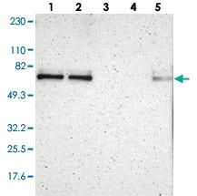 Anti-ZNF384 Rabbit Polyclonal Antibody