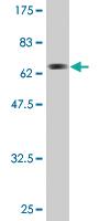 Anti-ACAT2 Mouse Monoclonal Antibody [clone: 4A5]