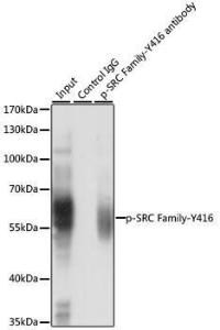 ANTI-LCK phospho Y416 FYN phospho 100 µl