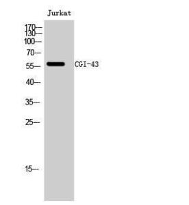 Western blot analysis of Jurkat cells using Anti-CG028 Antibody