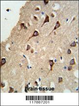 Anti-FYN Rabbit Polyclonal Antibody