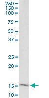 Anti-GOLGA7 Mouse Monoclonal Antibody [clone: 2H8]