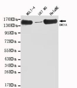 Anti-SMC1A Mouse Monoclonal Antibody [clone: 13k121]