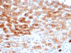 Anti-Cytokeratin 8 Mouse Recombinant Antibody [clone: rKRT8/6471]