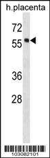 Anti-HCK Rabbit Polyclonal Antibody