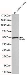 Anti-SMYD1 Mouse Monoclonal Antibody [clone: 13k123]