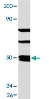 Anti-SSB Rabbit Polyclonal Antibody