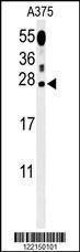 Anti-ITPA Rabbit Polyclonal Antibody