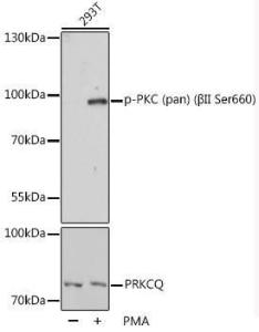 Western blot analysis of extracts of 293T cells, using Anti-pan PKC (phospho Ser660) Antibody (A10975) at 1:1,000 dilution or PRKCQ antibody (A5834). 293T cells were treated by PMA/TPA (200nM) for 30 minutes after serum-starvation overnight.