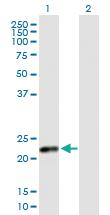 Anti-CSH2 Mouse Polyclonal Antibody