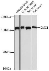 Western blot analysis of extracts of various cell lines, using Anti-DISC1 Antibody [ARC1089] (A307606) at 1:1,000 dilution. The secondary antibody was Goat Anti-Rabbit IgG H&L Antibody (HRP) at 1:10,000 dilution.