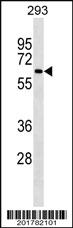 Anti-NCOA4 Mouse Monoclonal Antibody