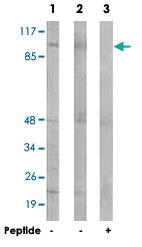 Anti-CLCN6 Rabbit Polyclonal Antibody