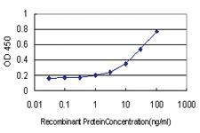 Anti-GOLGA7 Mouse Monoclonal Antibody [clone: 2H8]