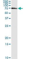 Anti-FANCG Antibody Pair