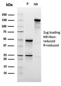 SDS-PAGE analysis of Anti-CD47 Antibody [CD47/3019] under non-reduced and reduced conditions; showing intact IgG and intact heavy and light chains, respectively. SDS-PAGE analysis confirms the integrity and purity of the antibody