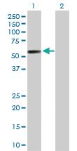 Anti-PI4K2A Rabbit Polyclonal Antibody