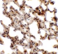 Anti-CORO7 Rabbit Polyclonal Antibody