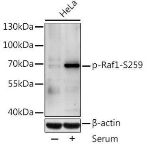 Western blot analysis of extracts of HeLa cells, using Anti-Raf1 (phospho Ser259) Antibody (A10977) at 1:1,000 dilution HeLa cells were treated by 10% FBS after serum-starvation overnight