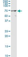 Anti-FANCG Polyclonal Antibody Pair