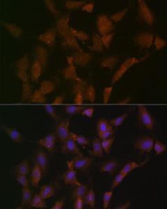 Immunofluorescence analysis of C6 cells using Anti-DISC1 Antibody [ARC1089] (A307606) at a dilution of 1:100 (40x lens). DAPI was used to stain the cell nuclei (blue).