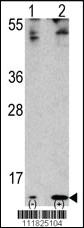 Anti-FAU Rabbit Polyclonal Antibody