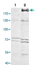 Anti-MRC1 Rabbit Polyclonal Antibody