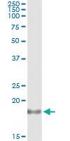 Anti-IL1RN Antibody Pair