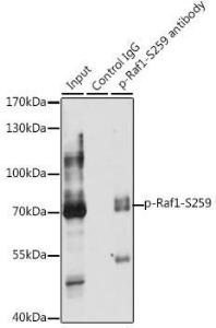 Immunoprecipitation analysis of 200 µg extracts of HeLa cells using 3 µg of Anti-Raf1 (phospho Ser259) Antibody (A10977)