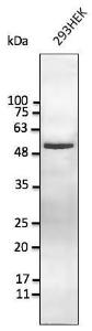 293HEK cell lysate detected with Anti-Vimentin Antibody at a 1:2,500 dilution. Lysate at 50 µg and rabbit anti-goat IgG antibody (HRP) at a 1:10,000 dilution