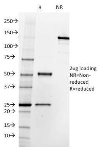 SDS-PAGE analysis of Anti-PSMA Antibody [SPM500] under non-reduced and reduced conditions; showing intact IgG and intact heavy and light chains, respectively. SDS-PAGE analysis confirms the integrity and purity of the antibody.