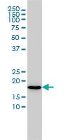 Anti-NAA20 Mouse Monoclonal Antibody [clone: 2C6]