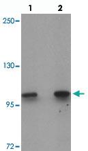 Anti-CORO7 Rabbit Polyclonal Antibody