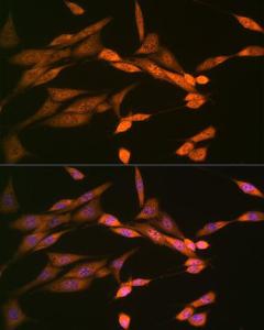 Immunofluorescence analysis of NIH-3T3 cells using Anti-DISC1 Antibody [ARC1089] (A307606) at a dilution of 1:100 (40x lens). DAPI was used to stain the cell nuclei (blue).