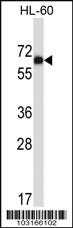 Anti-MATK Rabbit Polyclonal Antibody